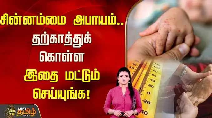 சின்னம்மை அபாயம்.. தற்காத்துக் கொள்ள இதை மட்டும் செய்யுங்க! | Smallpox Awareness