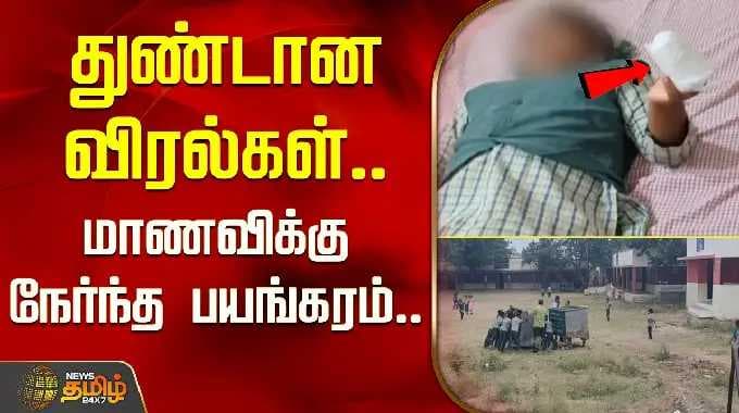 குப்பை தொட்டியில் சிக்கி துண்டான விரல்கள்.. பள்ளியில் மாணவிக்கு நேர்ந்த பயங்கரம்.. | Kallakurichi